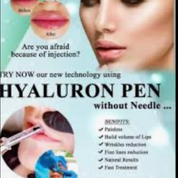 Luscious Lips - Picture 2 of 6